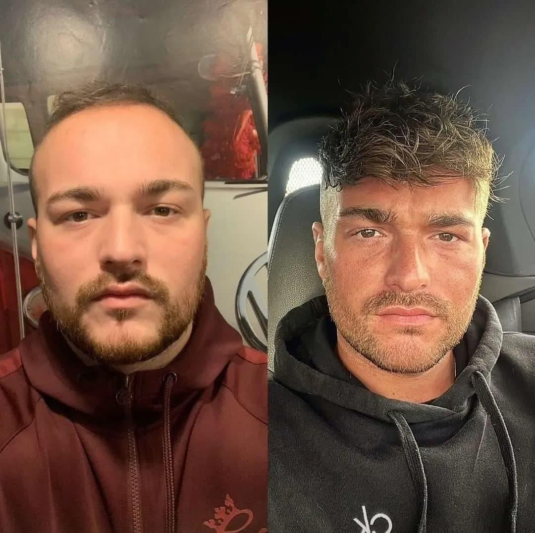 Breaking Down does mick jagger wear a wig with photos, expert comments and a timeline of his hair